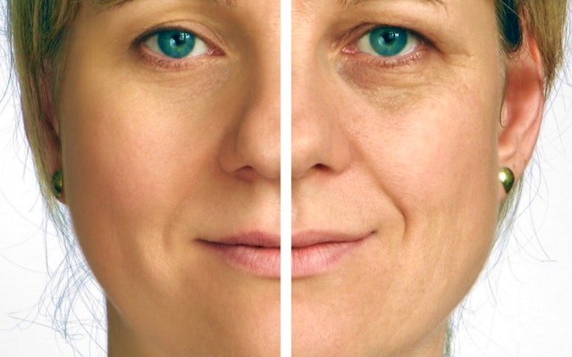 Laser Facelift; 3 gelaats- en halsbehandelingen door Perfect You Skin Clinic!